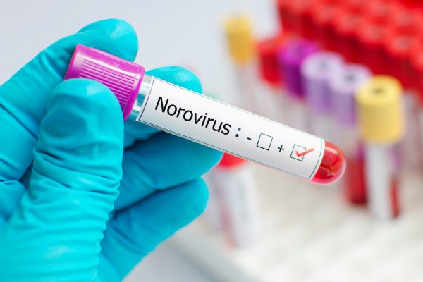 Cảnh báo nguy hiểm khi mắc norovirus