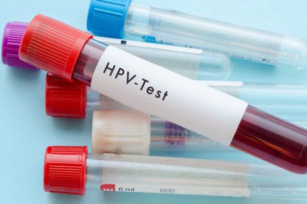 xét nghiệm virus hpv